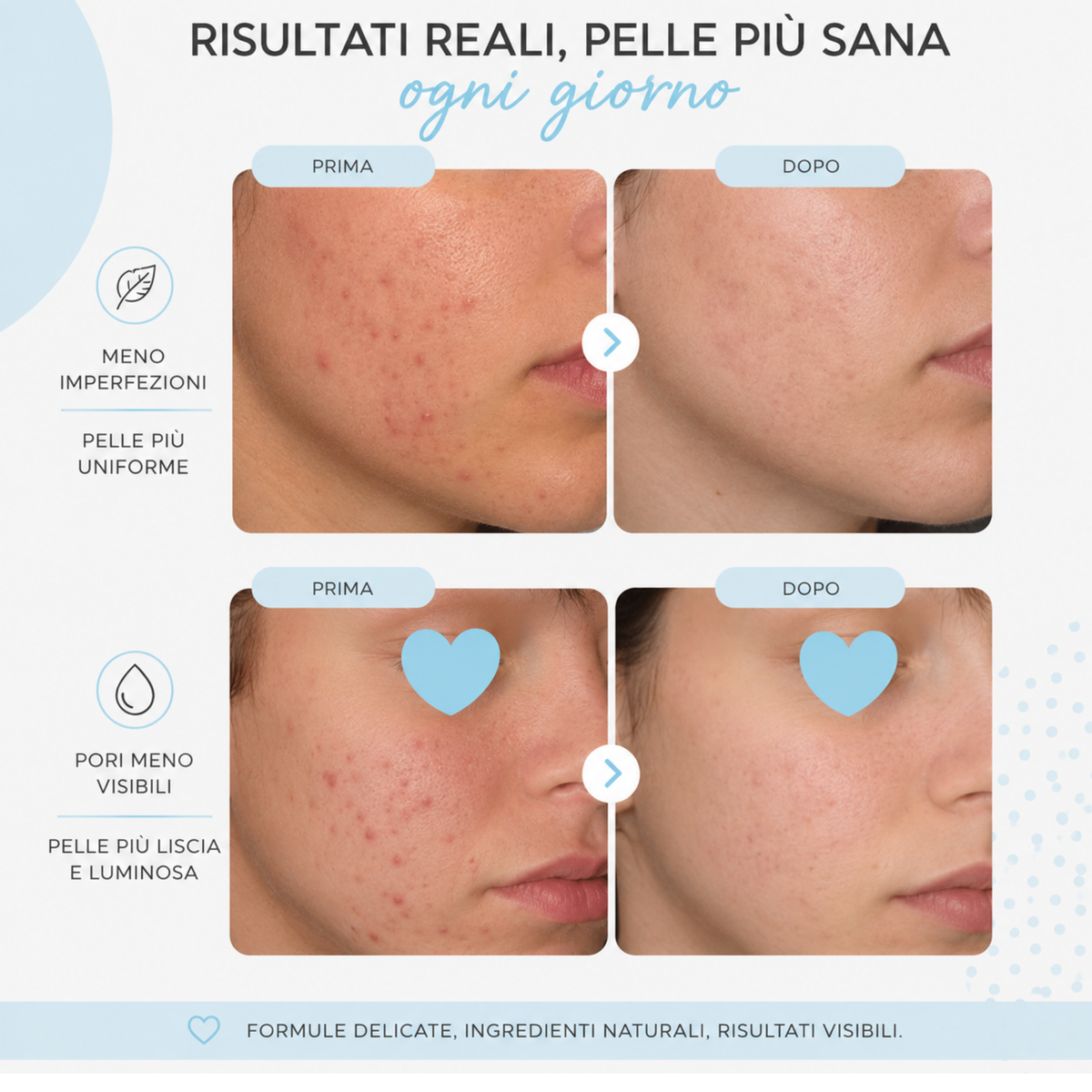 I CHOOSE WISELY   Crema viso purificante & idratante 50ml