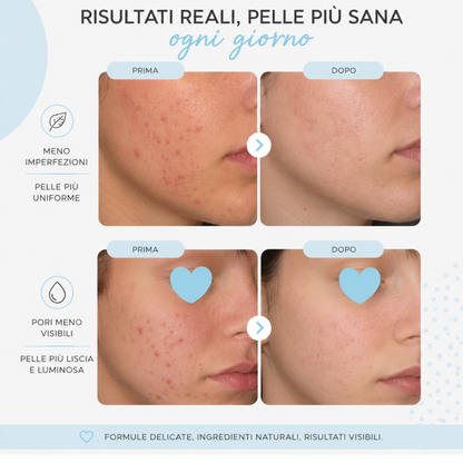 I CHOOSE WISELY   Crema viso purificante & idratante 50ml
