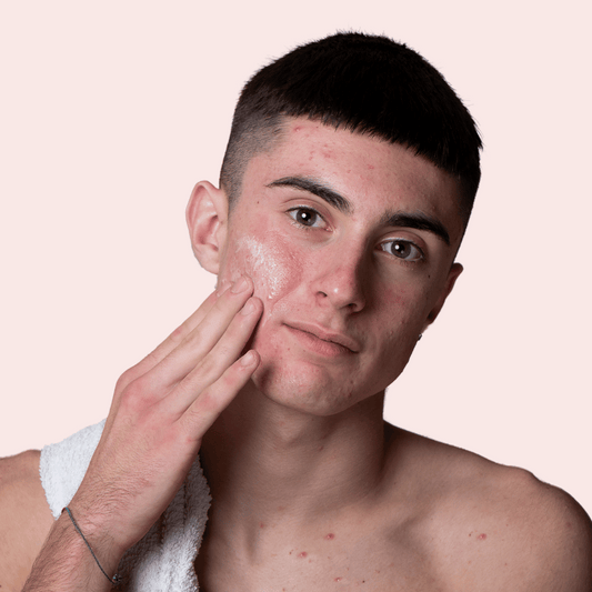 DAILY ROUTINE for blemish and acne-prone skin